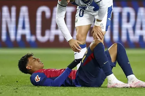 يامال ليس الأخير.. "إصابات العانة" جرس إنذار يهدد نجوم الدوري الإسباني